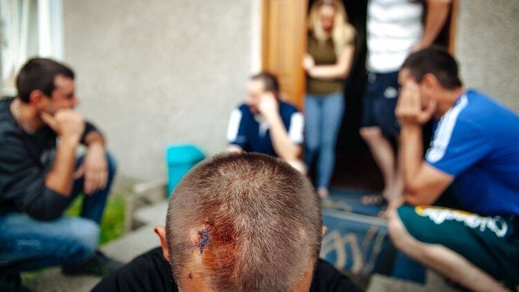 Пару лет назад в Гданьске отбили почки заробитчанам из Украины. Нападения продолжаются и по сей день. Фото: 