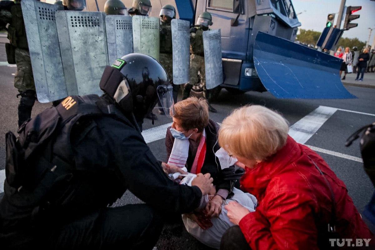 Раненые после столкновений с силовиками в Минске. Фото: Tut.by